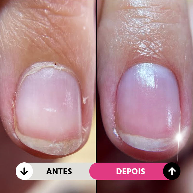 Lixa Elétrica NailGlam 5 em 1 Sem Fio: Manicure Pedicure Profissional Rápida