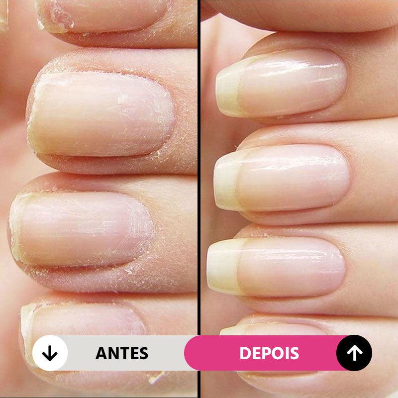 Lixa Elétrica NailGlam 5 em 1 Sem Fio: Manicure Pedicure Profissional Rápida