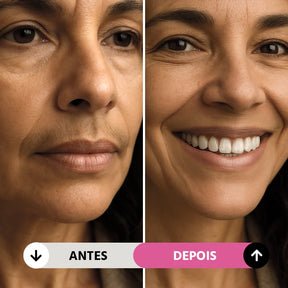 Depilador Facial SkinGlam Portátil: Remoção Indolor e Discreta para Buço e Rosto